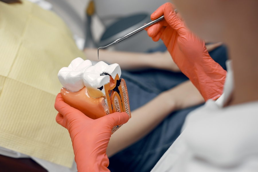 Endodonti (Kanal Tedavisi)